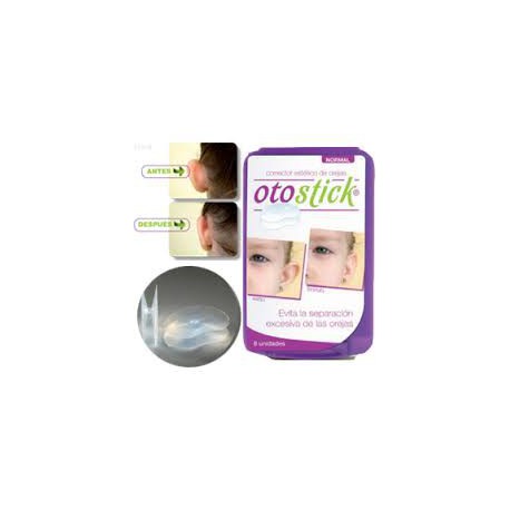 Otostick Baby - Cosmetic Ear Correctors - Set of 8 Correctors, Infant Unisex, Size: One size, Clear